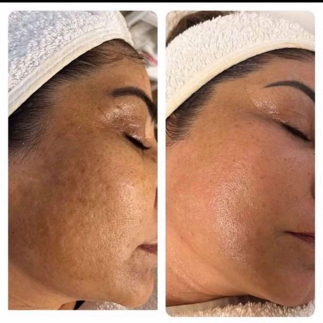 Crema Skin-Care Koreano 2% Niacinamina