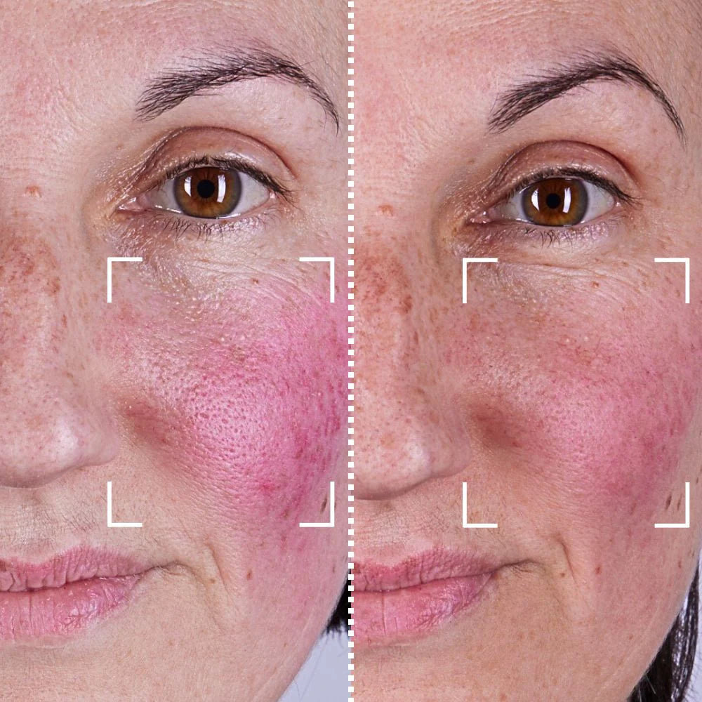 Masajeador Facial y de Cuello con Luz LED